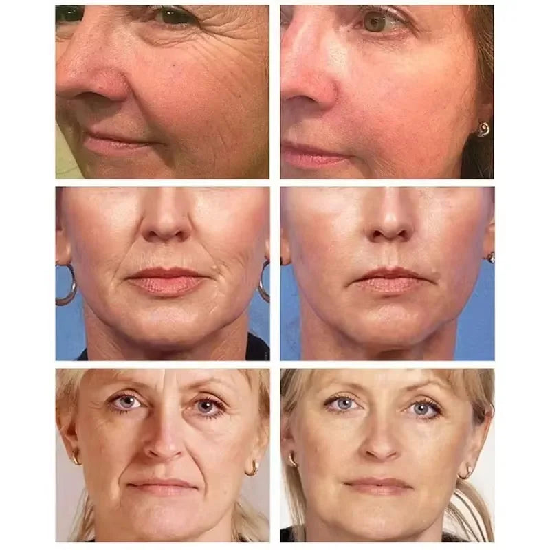 Máscara facial removedora instantânea de rugas, colágeno, antienvelhecimento, firmeza, lifting, desbotamento de linhas finas, clareamento, hidratação, clareamento, cuidados com a pele